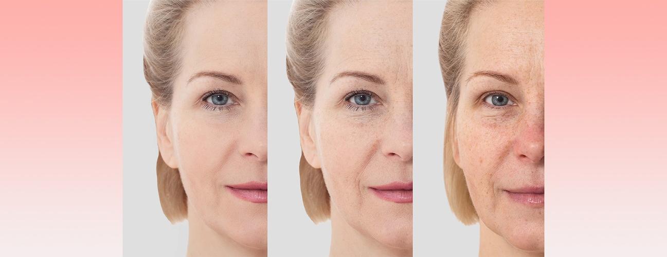 关闭-up image of a woman’s face showing before-and-after cosmetic treatment.